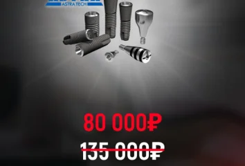 Имплант ASTRA под ключ